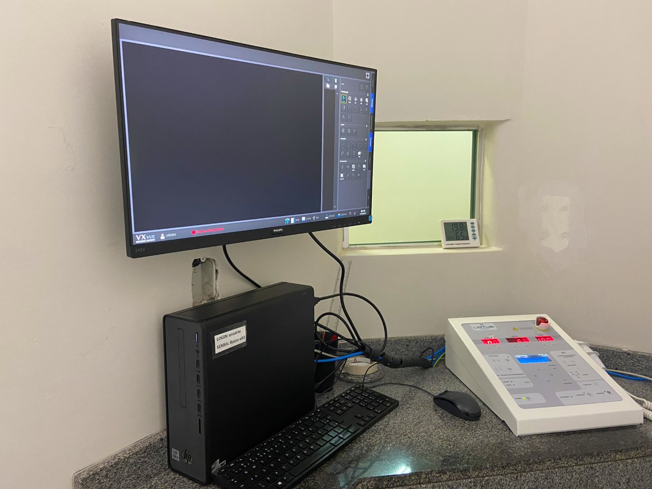 Centro Radiológico de Ibaté recebe novo e moderno equipamento de Raio-X